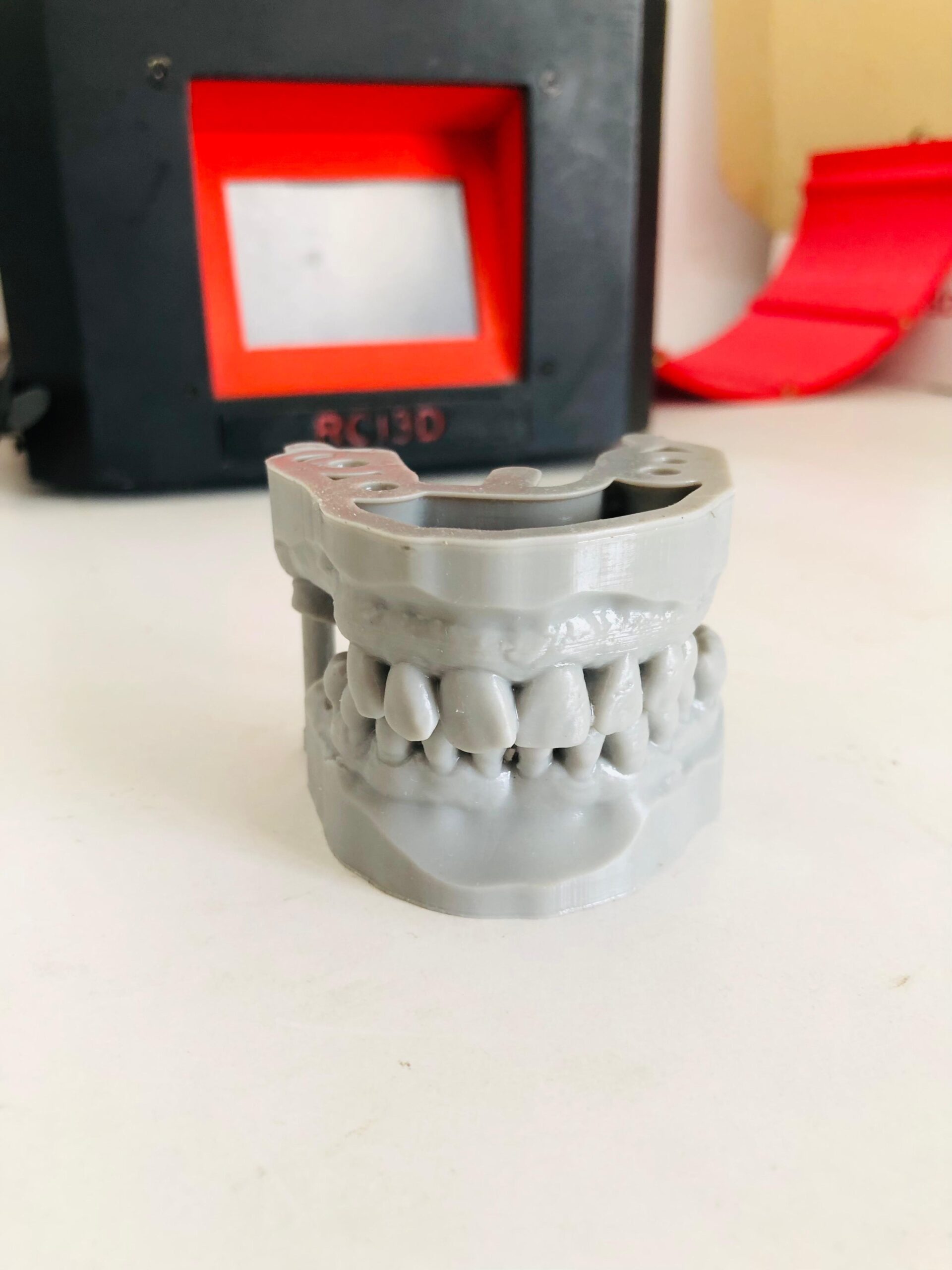 Modèle dentaire imprimé en 3D